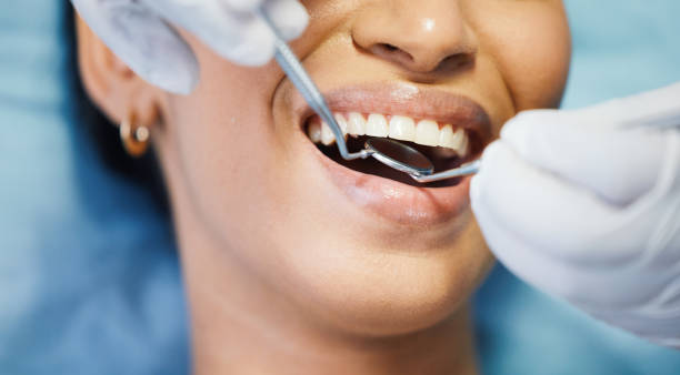 Best Emergency Tooth Extraction in Oakboro, NC
